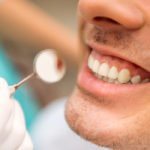 ortodoncia invisible: tratamiento para dientes apiñados