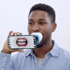 Invisalign Lens: fotos mejores con Invisalign Lens (guía para pacientes)