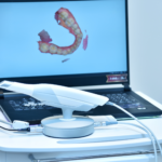 https://invisalignsaragil.es/escaneo-intraoral-invisalign-plan-3d/