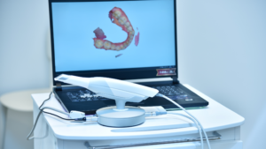Escaneo intraoral Invisalign: cómo se planifica tu tratamiento en 3D